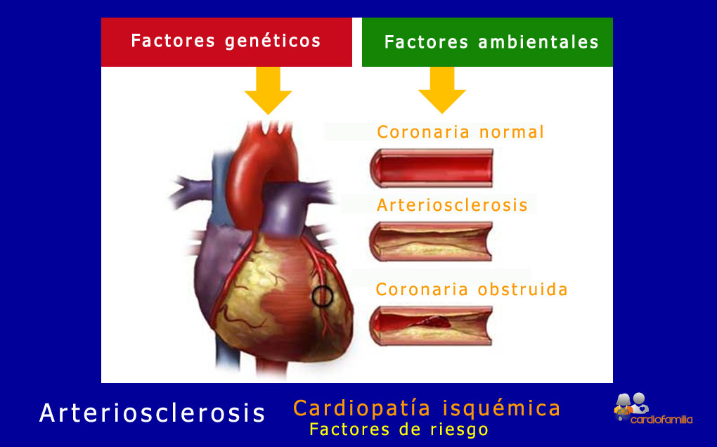 Factores riesgo cardiopatia isquemicax580 www.cardiofamilia.org
